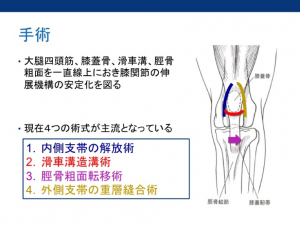 犬膝蓋骨脱臼　手術方法