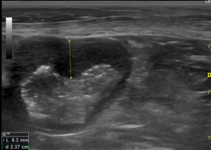 犬　空腸リンパ節　超音波画像
