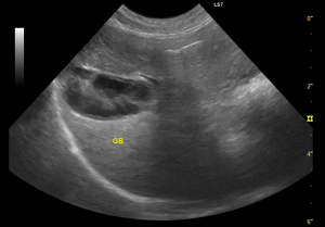 犬　胆嚢粘液嚢腫　超音波画像
