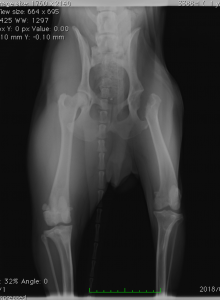 大腿骨頭骨頚切除術