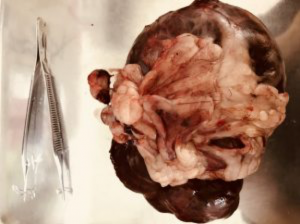 犬　肝臓腫瘍　肝細胞癌